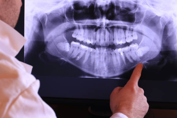 Best Walk-In Emergency Dentist in Captains Cove, VA