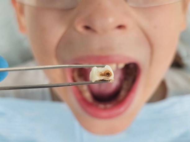 Best Weekend Emergency Dentist in Captains Cove, VA