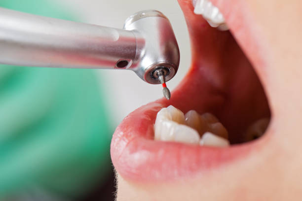 Best Emergency Dental Surgery in Captains Cove, VA